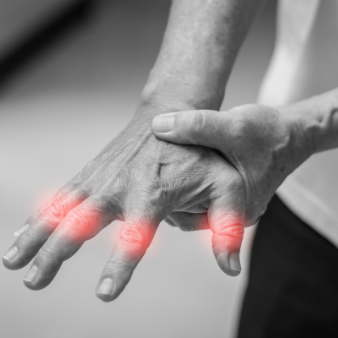 rheumatoid arthritis - osteoarthritis